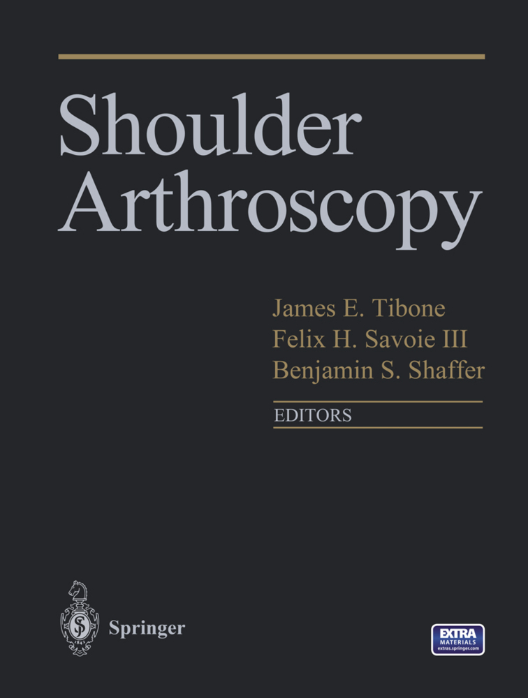 Shoulder Arthroscopy, w. DVD-ROM
