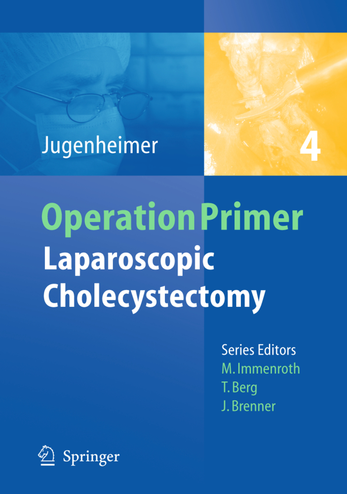 Laparoscopic Cholecystectomy