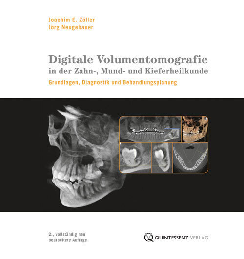 Digitale Volumentomografie in der Zahn-, Mund- und Kieferheilkunde, m. DVD-ROM