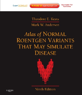 Atlas of Normal Roentgen Variants That May Simulate Disease