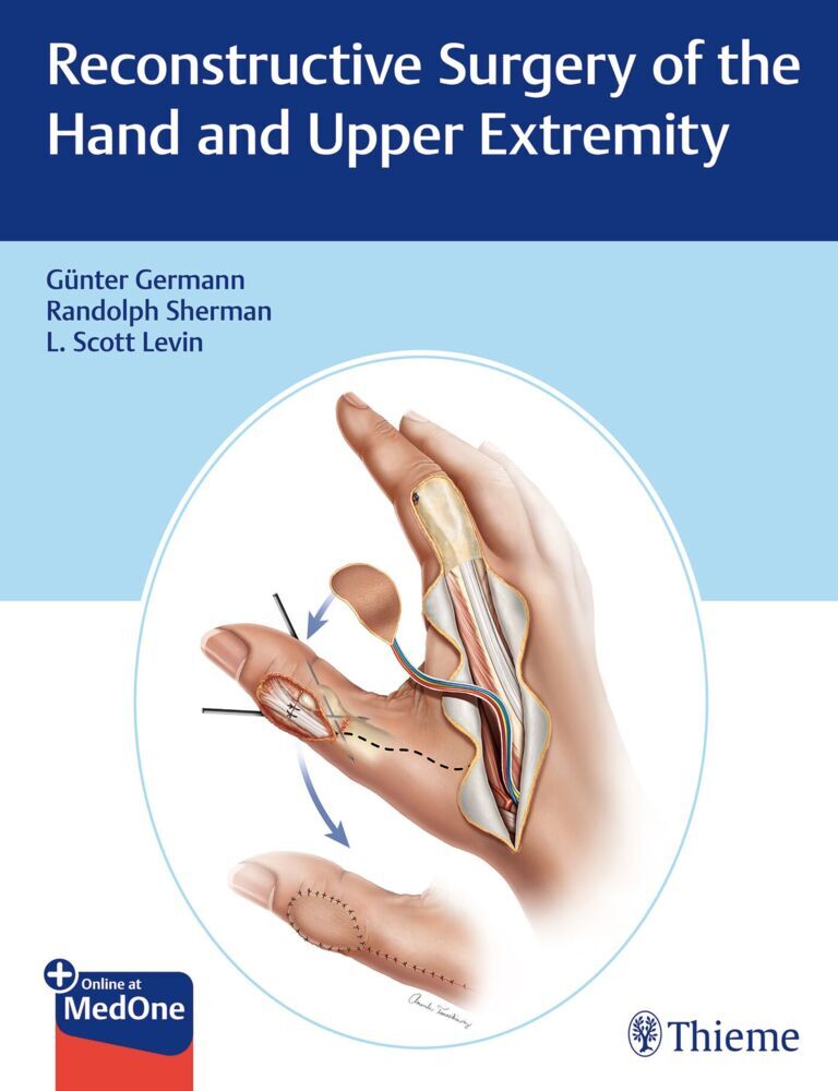 Reconstructive Surgery of the Hand and Upper Extremity