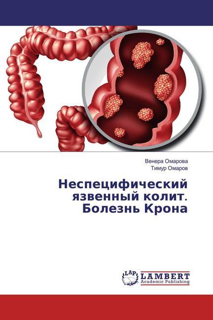 Nespecificheskij qzwennyj kolit. Bolezn' Krona
