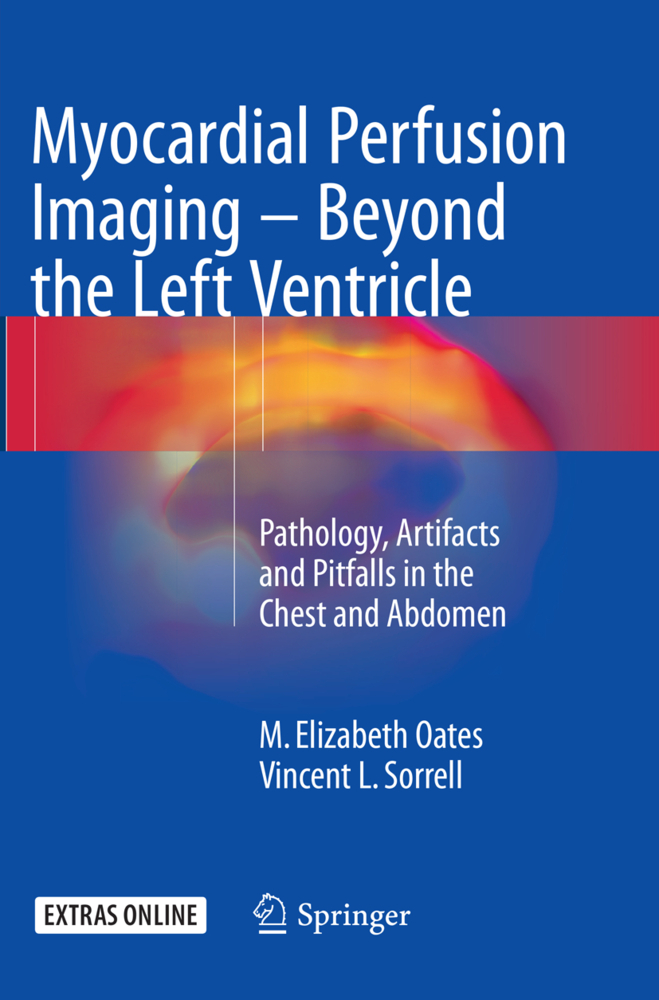 Myocardial Perfusion Imaging - Beyond the Left Ventricle