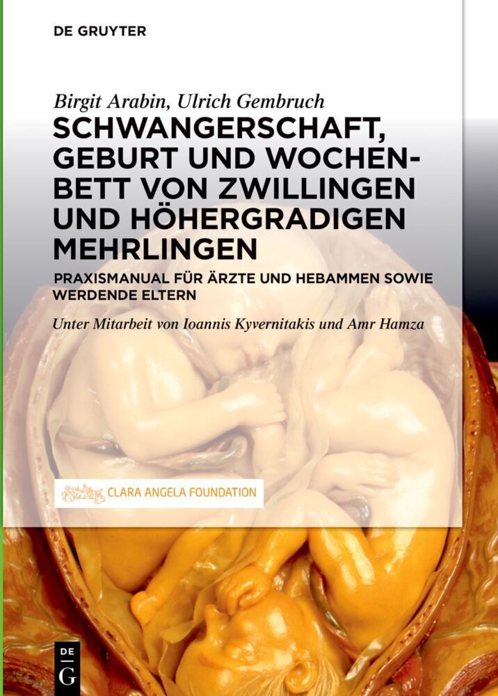 Schwangerschaft, Geburt und Wochenbett von Zwillingen und höhergradigen Mehrlingen