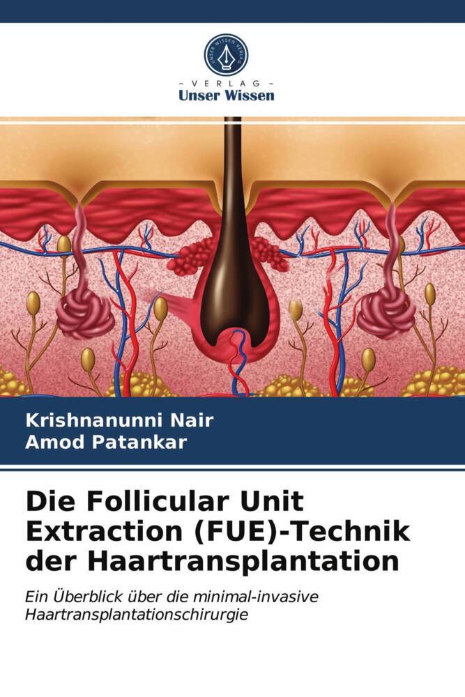 Die Follicular Unit Extraction (FUE)-Technik der Haartransplantation