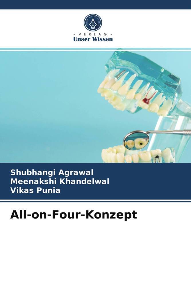 All-on-Four-Konzept