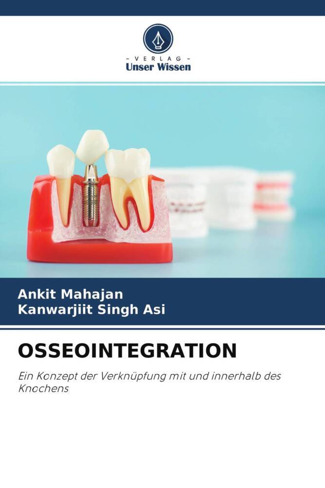 OSSEOINTEGRATION