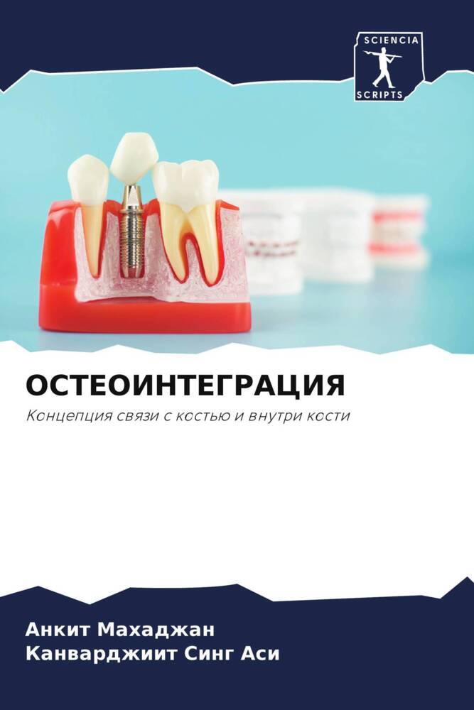 OSTEOINTEGRACIYa