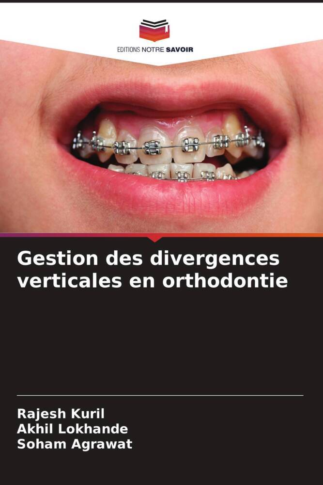 Gestion des divergences verticales en orthodontie