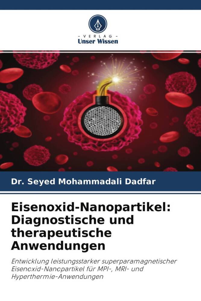 Eisenoxid-Nanopartikel: Diagnostische und therapeutische Anwendungen