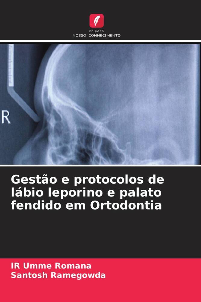 Gestão e protocolos de lábio leporino e palato fendido em Ortodontia
