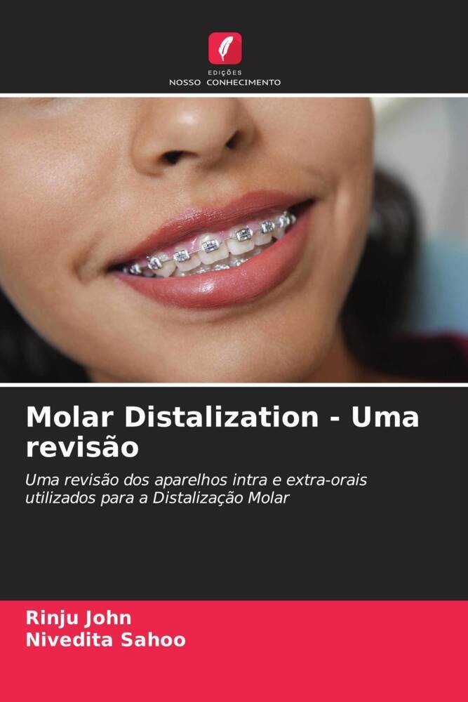 Molar Distalization - Uma revisão
