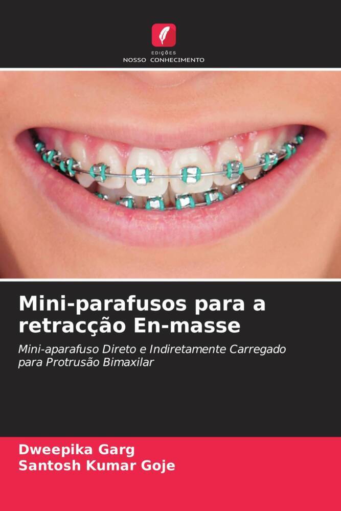 Mini-parafusos para a retracção En-masse