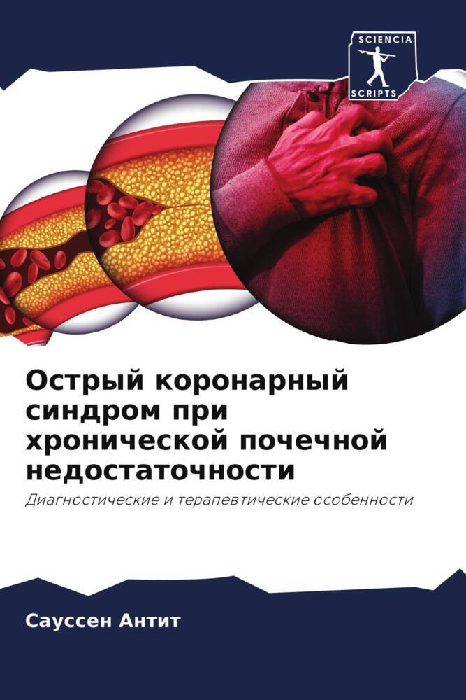 Ostryj koronarnyj sindrom pri hronicheskoj pochechnoj nedostatochnosti