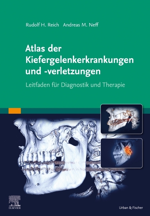 Atlas der Kiefergelenkerkrankungen und -verletzungen