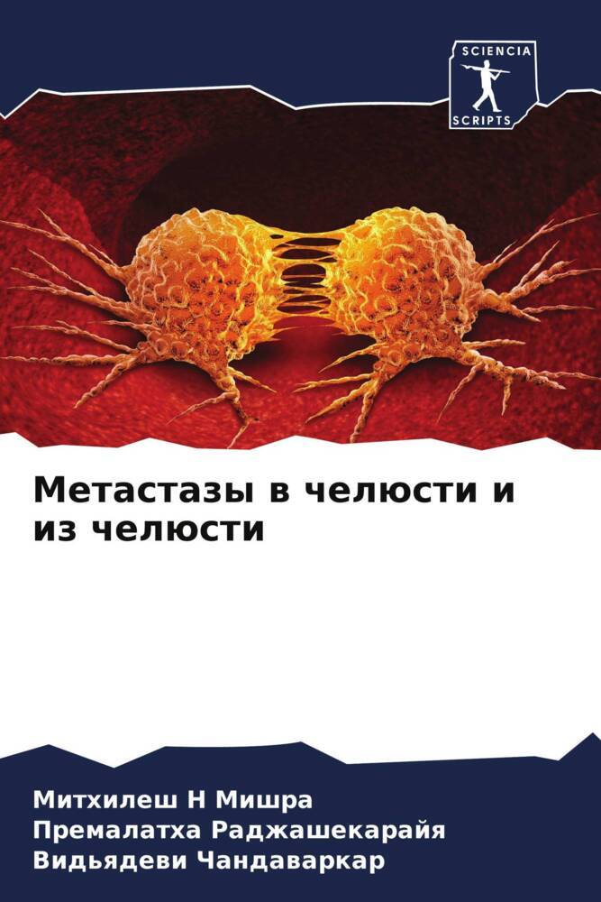 Metastazy w chelüsti i iz chelüsti