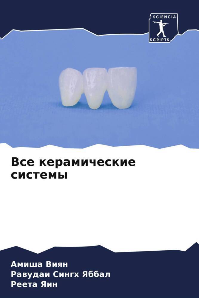 Vse keramicheskie sistemy