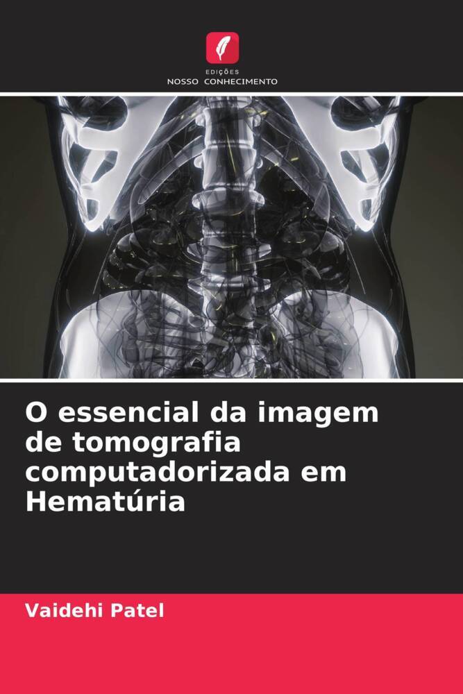 O essencial da imagem de tomografia computadorizada em Hematúria