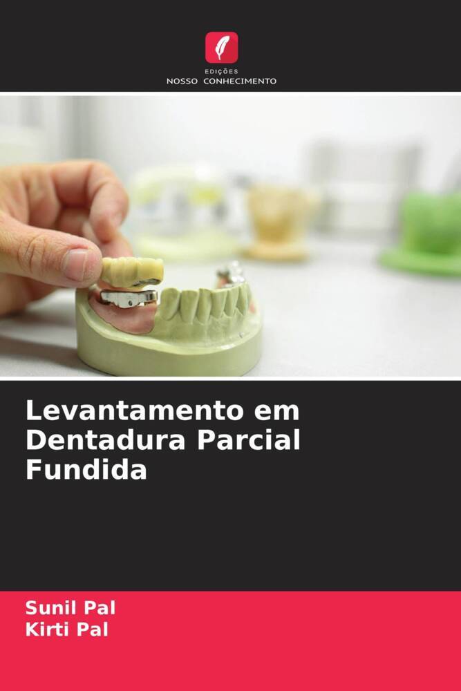 Levantamento em Dentadura Parcial Fundida