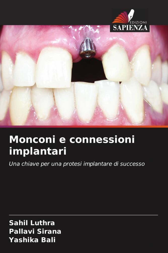 Monconi e connessioni implantari