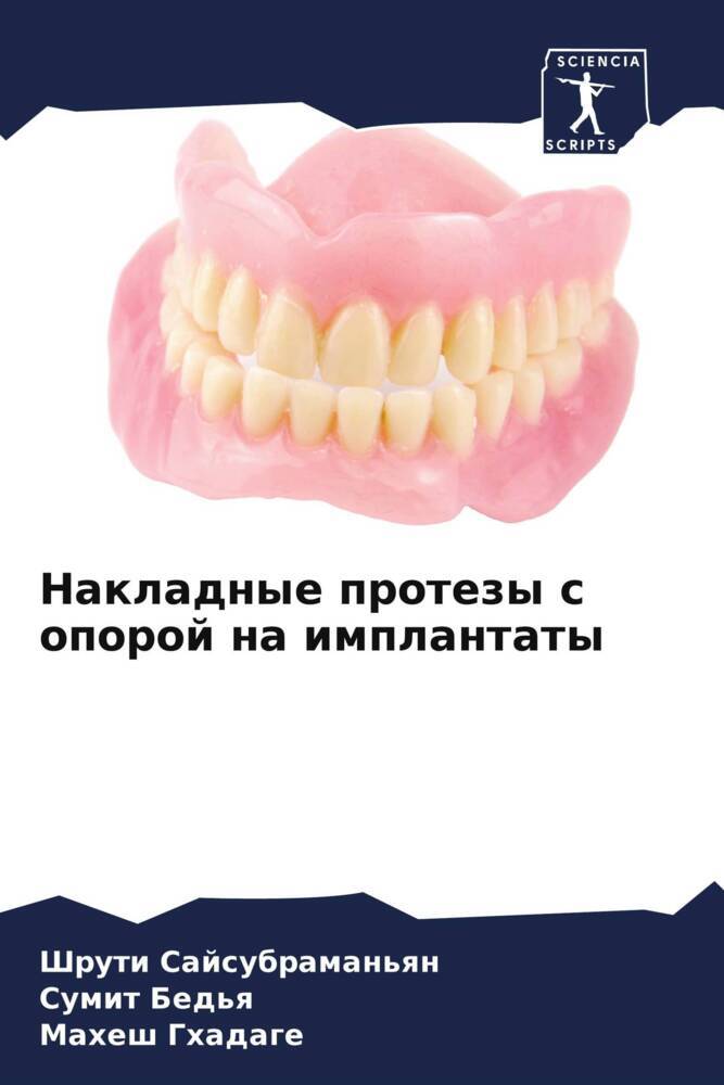 Nakladnye protezy s oporoj na implantaty