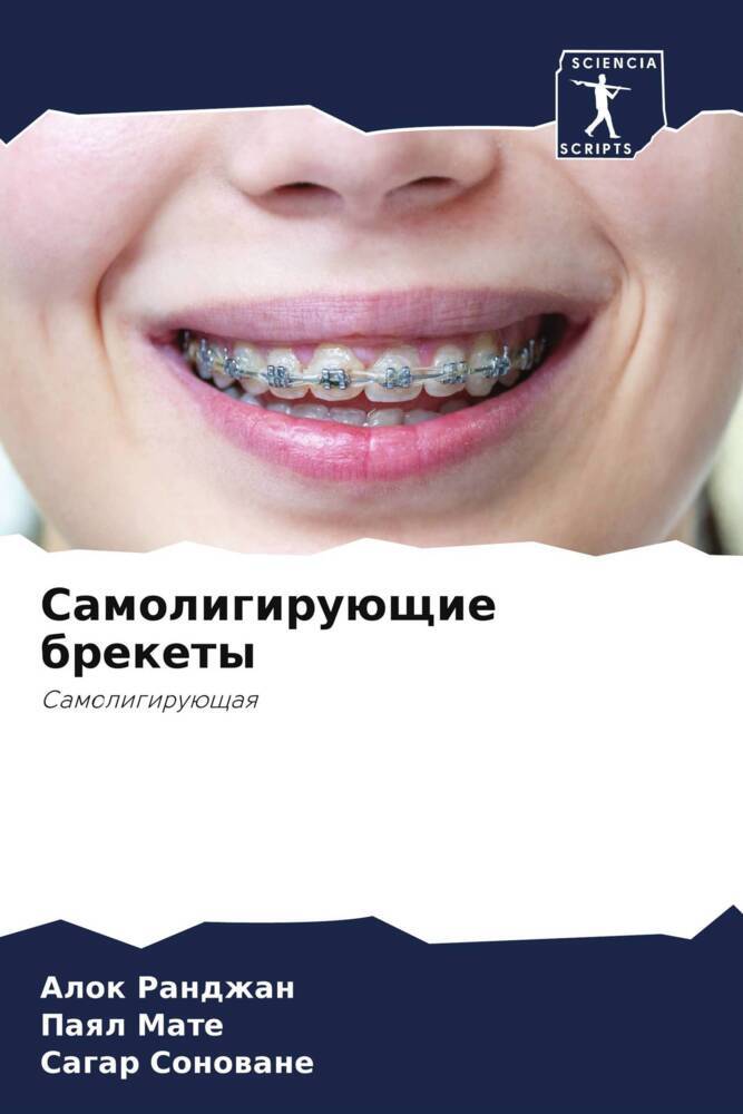 Samoligiruüschie brekety