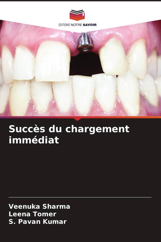 Succès du chargement immédiat