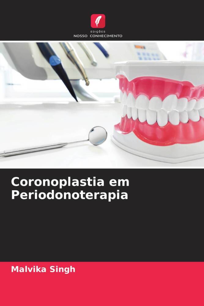 Coronoplastia em Periodonoterapia