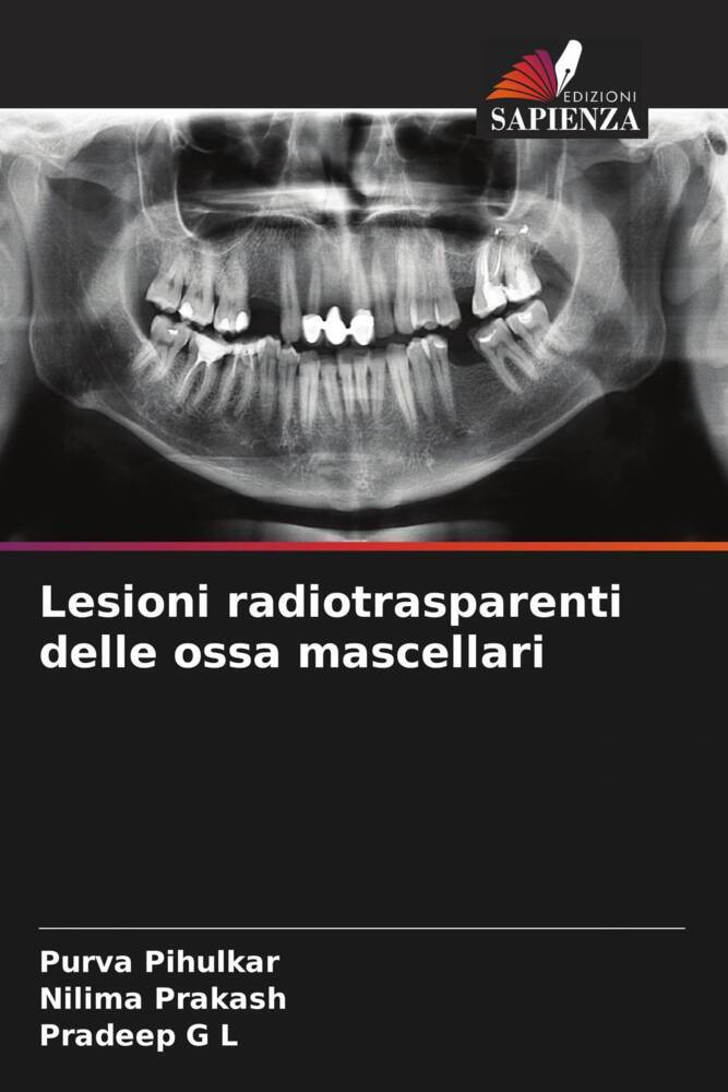 Lesioni radiotrasparenti delle ossa mascellari