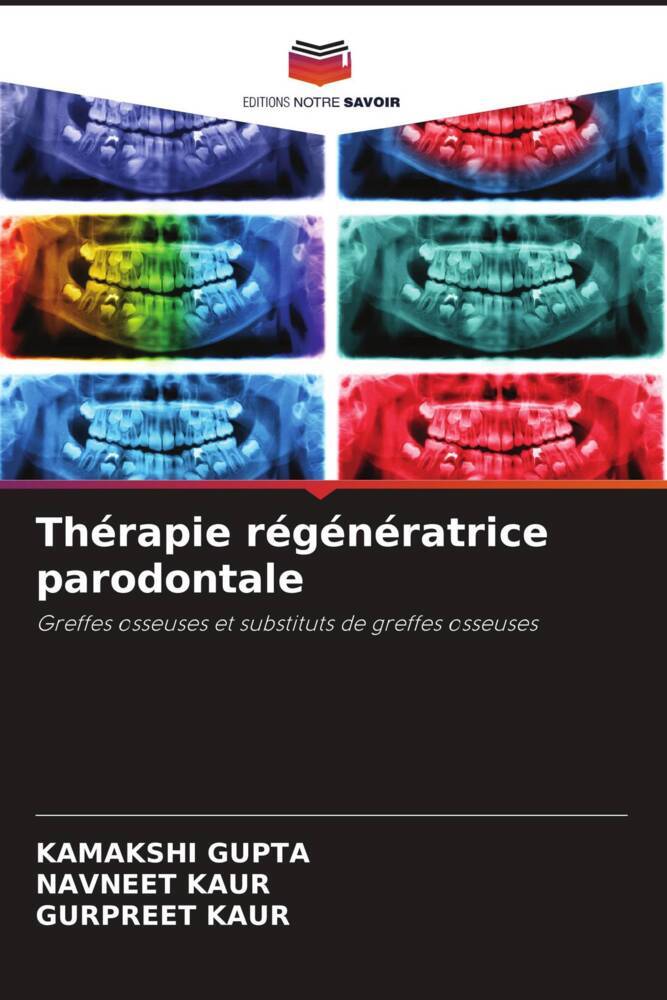 Thérapie régénératrice parodontale