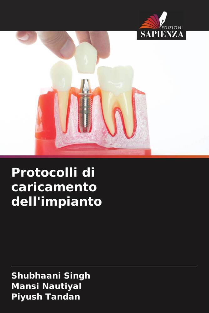 Protocolli di caricamento dell'impianto