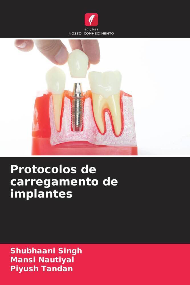 Protocolos de carregamento de implantes