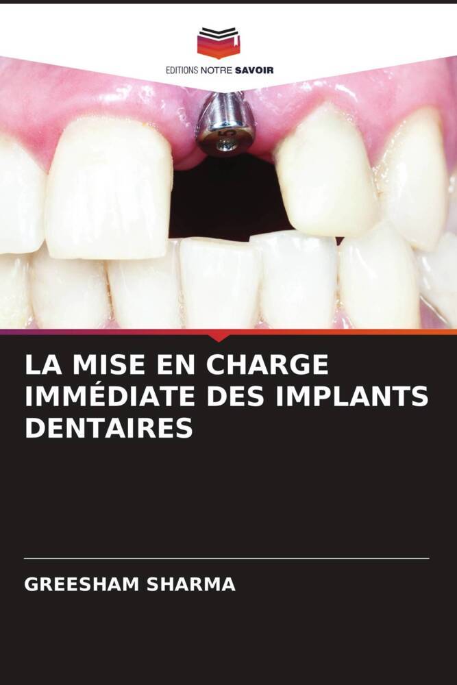 LA MISE EN CHARGE IMMÉDIATE DES IMPLANTS DENTAIRES