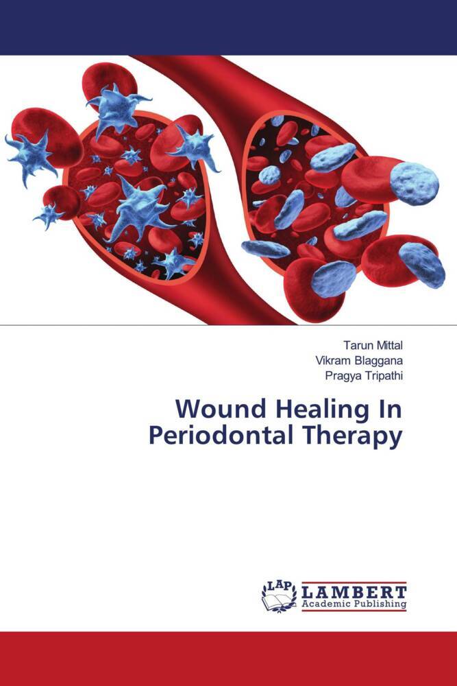 Wound Healing In Periodontal Therapy