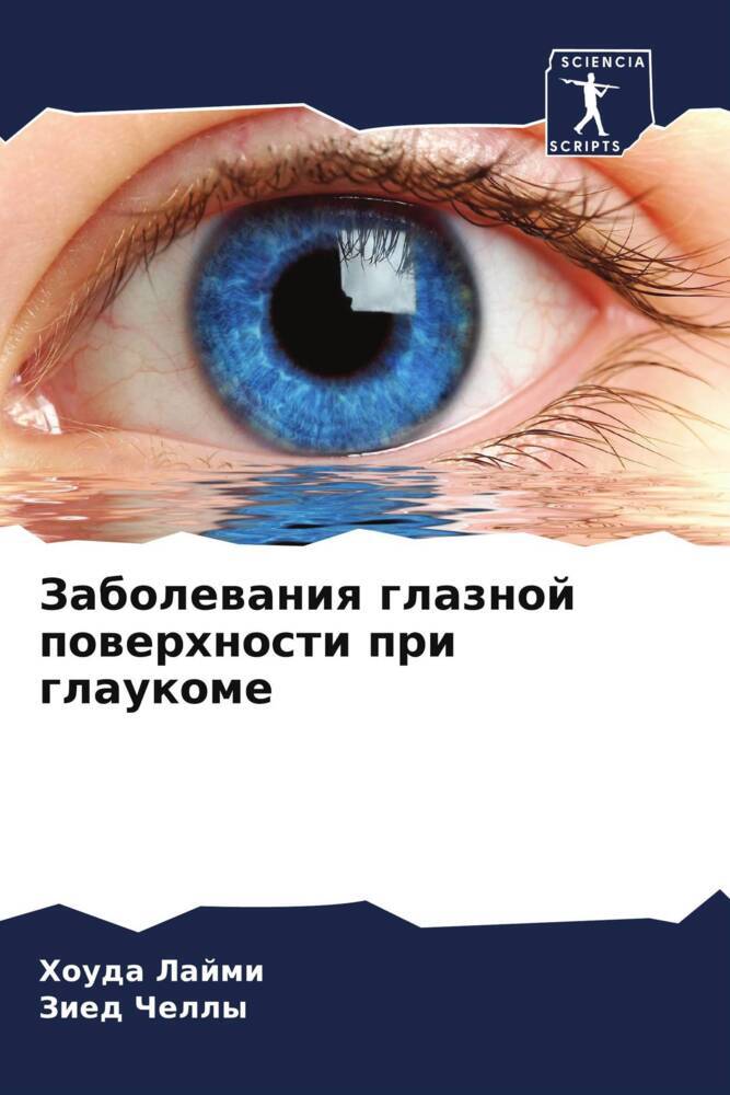 Zabolewaniq glaznoj powerhnosti pri glaukome
