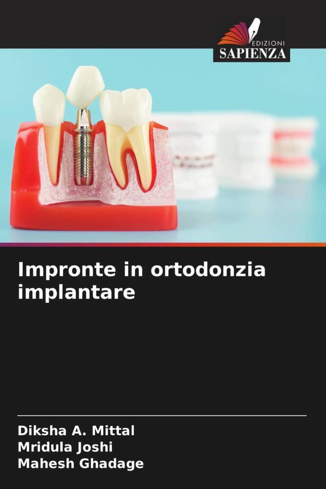 Impronte in ortodonzia implantare