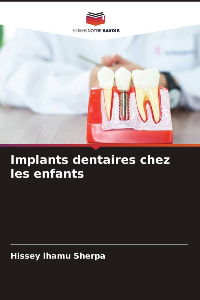 Implants dentaires chez les enfants