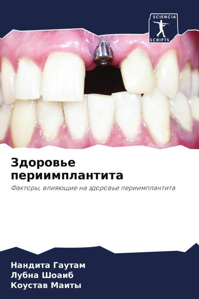 Zdorow'e periimplantita
