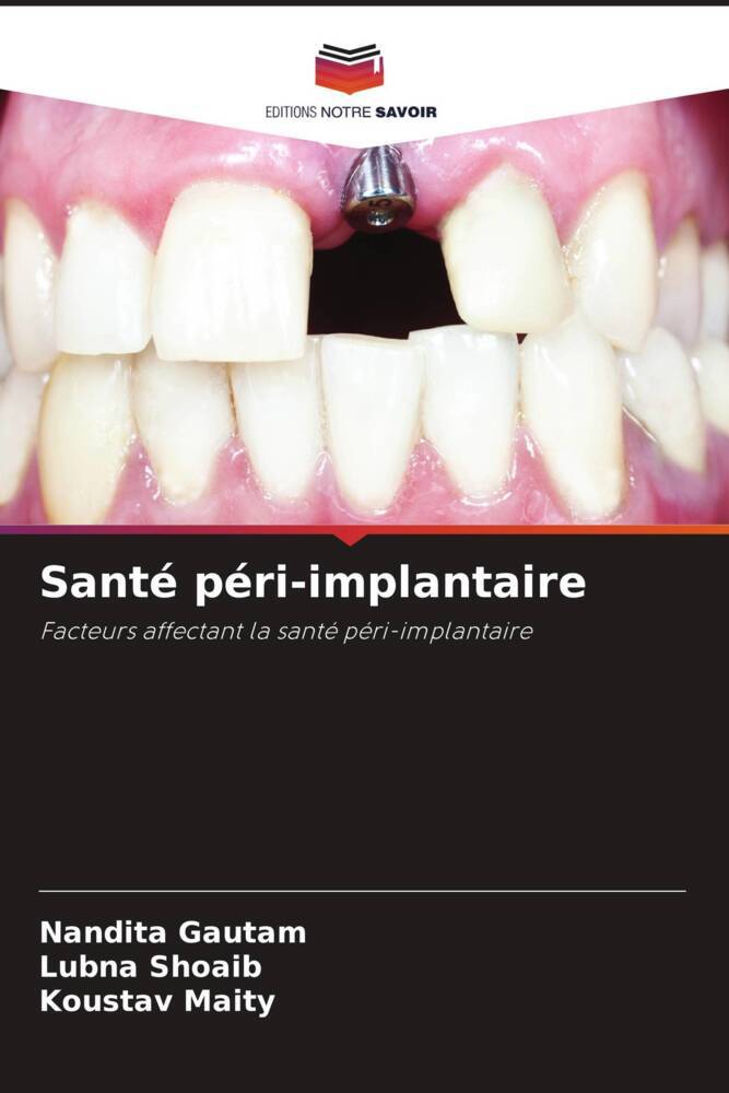 Santé péri-implantaire
