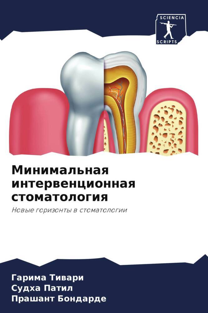 Minimal'naq interwencionnaq stomatologiq