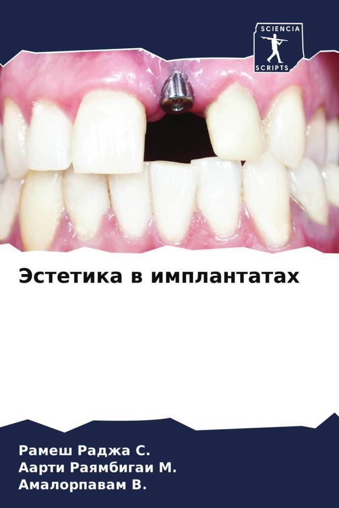 Jestetika w implantatah
