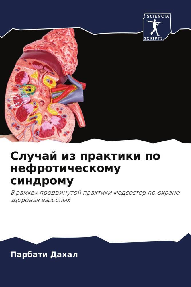 Sluchaj iz praktiki po nefroticheskomu sindromu