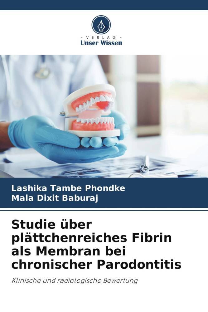 Studie über plättchenreiches Fibrin als Membran bei chronischer Parodontitis