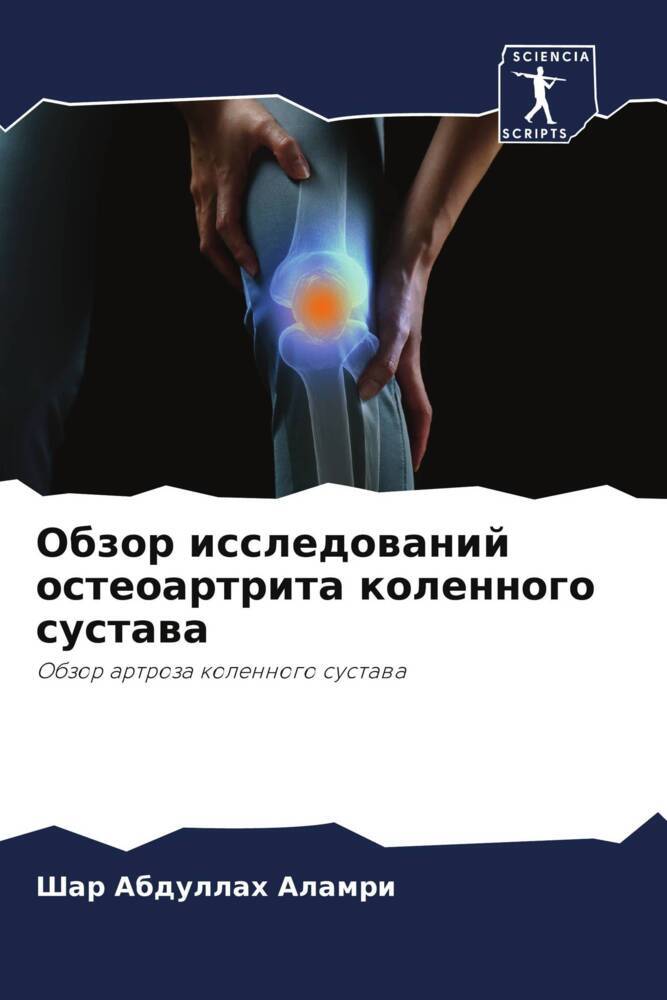 Obzor issledowanij osteoartrita kolennogo sustawa