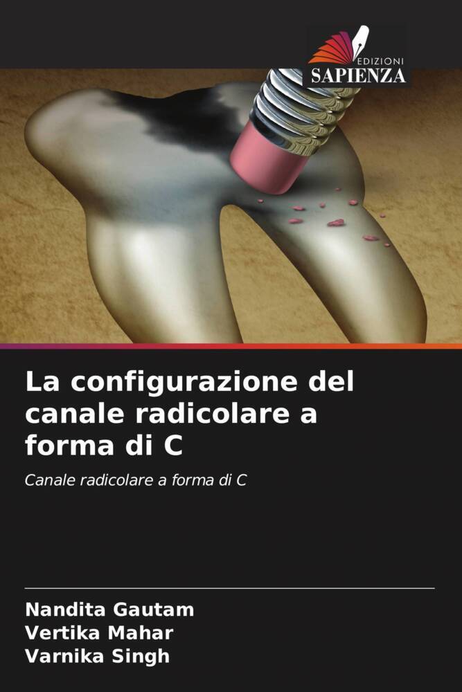 La configurazione del canale radicolare a forma di C