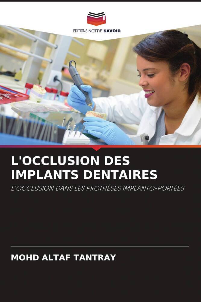 L'OCCLUSION DES IMPLANTS DENTAIRES