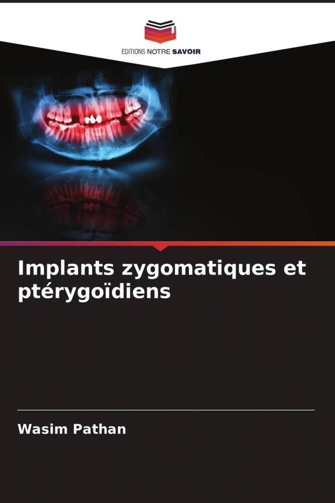 Implants zygomatiques et ptérygoïdiens