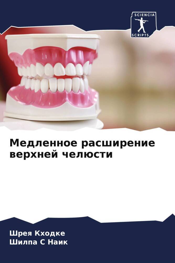 Medlennoe rasshirenie werhnej chelüsti