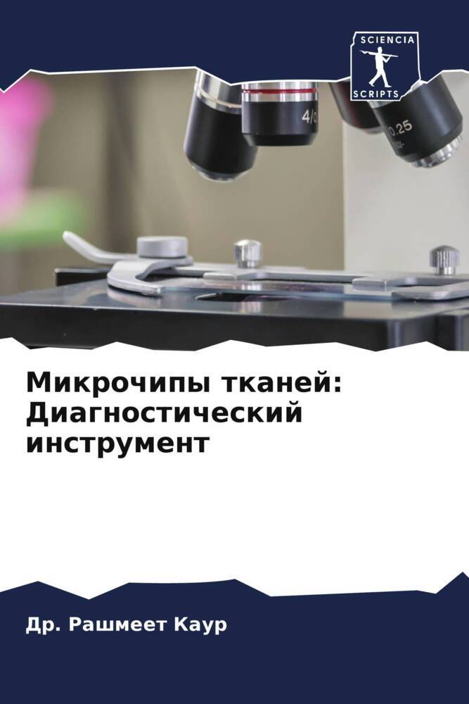 Mikrochipy tkanej: Diagnosticheskij instrument