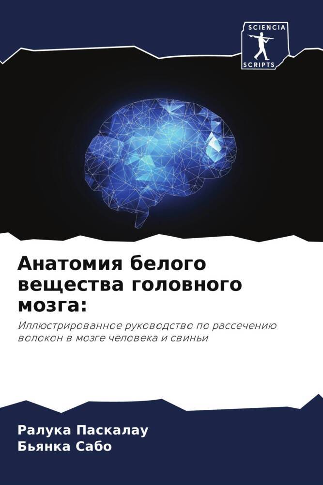 Anatomiq belogo weschestwa golownogo mozga:
